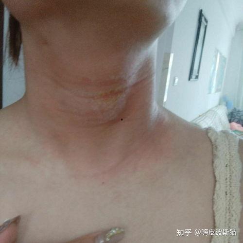 成人趣味脖子装饰视频,创意无限，时尚新潮流